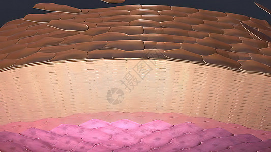 皮肤癌3D例 在皮肤组织下生长的肿瘤诊断化疗疾病摄影保健预防癌症生活医学子宫颈图片