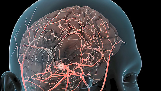 脑动脉瘤爆发导致脑细胞出血 造成脑大出血解剖学基底系统神经系统动脉中脑高血压卫生形成疾病图片