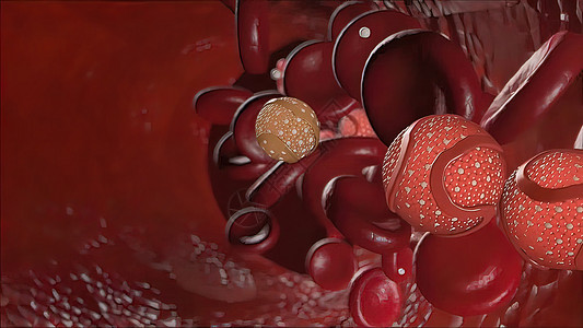 身体内胆固醇导致血管隔绝微生物学细胞质化学血浆系统疾病生物药品癌症黄疸图片