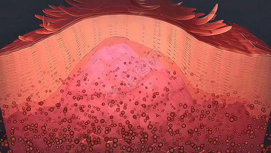 皮肤癌3D例 在皮肤组织下生长的肿瘤疾病癌症子宫颈前列腺胸部身体划分细胞学治疗生活图片