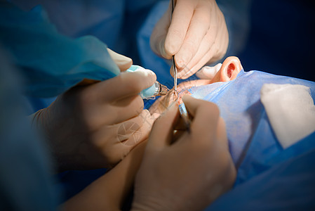 激光眼睑成形术 用于矫正眼睑缺陷 畸形和毁容的整形外科手术 从美学上修饰面部的眼部区域女性毒素起重工作医生治疗护理神经化妆品塑料图片