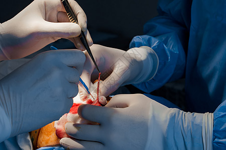 外科医生进行塑料手术 2名外科医生将皮肤从眼皮切除出来 横截面性脑膜炎线条病人工作激光药品操作医院老化程序化妆品图片