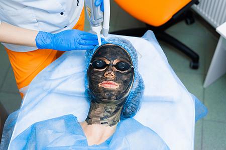 女性面部激光光子嫩肤和碳剥离 黑色面罩 皮肤科和美容科 使用手术激光化妆品病人治疗白头皱纹方法程序老化胶原照片图片