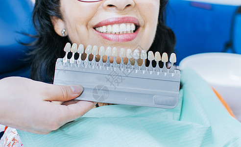牙科诊所的美容牙齿美白 种植牙色调的选择 女人拿着一套带有各种色调的种植体 微笑的年轻女人图片