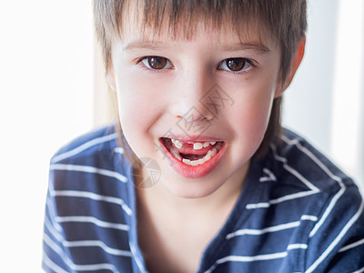 微笑的孩子嘴里有一排牙齿的洞 一个切口器刚刚掉出来 给牙医贴上牙套的照片门牙牙科磨牙展示保健男生牙科学口腔牙龈药品图片