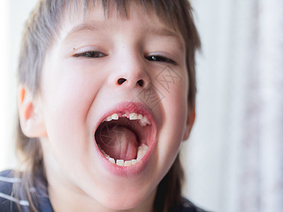 微笑的孩子嘴里有一排牙齿的洞 一个切口器刚刚掉出来 给牙医贴上牙套的照片嘴唇门牙童年宏观牙科男生展示口腔磨牙生长图片