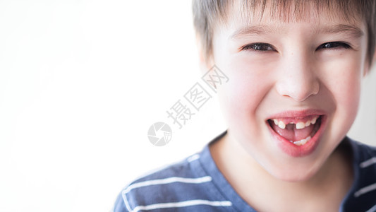 微笑的孩子嘴里有一排牙齿上有洞 一颗门牙刚刚掉了 为牙医特写牙龈照片 复制空间生长宏观展示矫正童年保健牙科嘴唇横幅男生图片