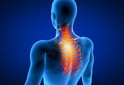 3d在医学上准确无误地说明一名男子有痛苦的颈部图片