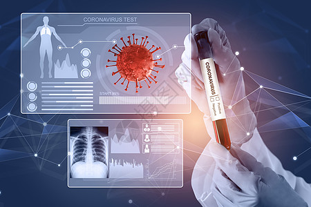 Corona病毒 COVID19医学测试疫苗研发概念过程医院样本肺炎药品研究学习科学技术实验疫情图片