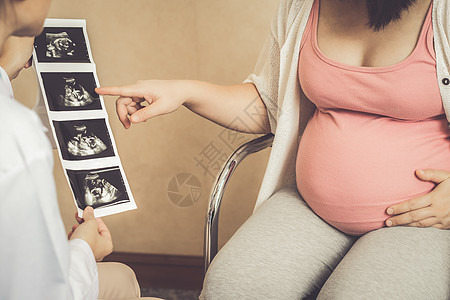 医院的孕妇和妇产科医生病人保健母亲妇科生育力超声分娩孕肚妇科医生卫生背景图片