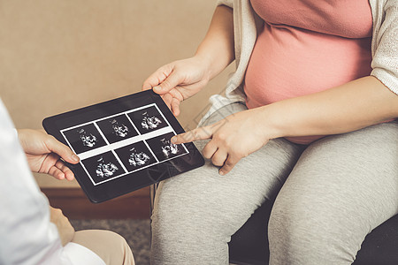 医院的孕妇和妇产科医生母亲母性女士治疗照片分娩胎儿扫描怀孕诊所图片