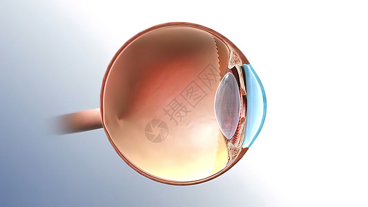 眼睛Glaucoma眼病 3D例感染保健皮肤药品医生疼痛宏观细菌皮肤科脓肿背景