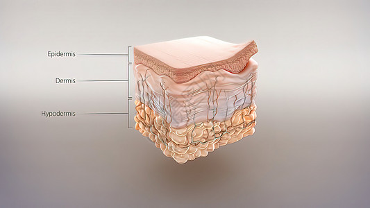 皮肤解解剖结构晒斑表皮图表身体癌症图层烫伤卵泡真皮烧伤图片