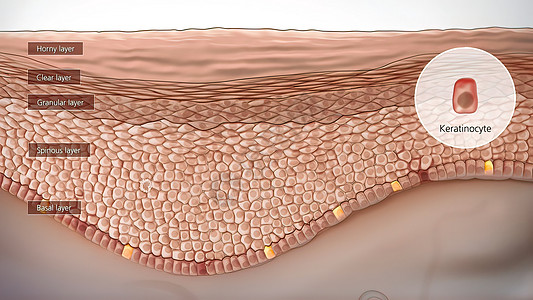 皮肤解解剖结构损害插图事故图层解剖学癌症细胞卵泡疼痛图表图片