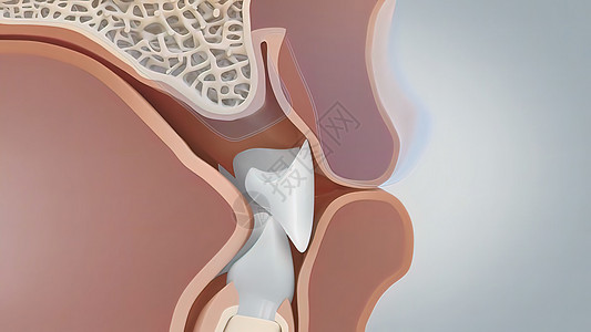 如果口香糖消退太多 可能导致骨折 导致牙齿松散或脱落卫生超声波经济衰退差距假牙牌匾宏观牙医细菌疾病图片