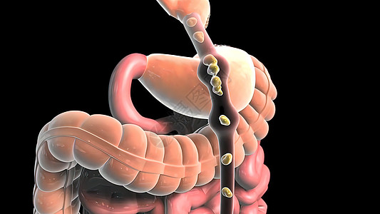 食物通过消化道流经膀胱肠道系统体积阴影宽慰大肠作品尿道背景图片