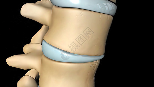 脊椎绳索 正常的横交盘3D骨赘疾病腰椎器官神经脊柱磁盘神经学家骨刺骨科图片