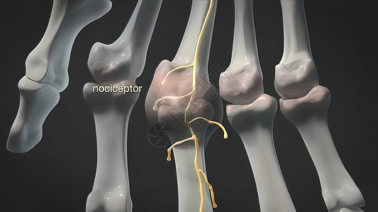 肿胀和发炎的手指关节腕骨插图肌肉风湿病手腕疼痛痛苦医院身体生物学图片