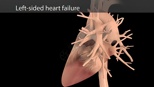 心脏衰竭中左心部的中心作用主动脉动脉耳廓金属心脏病学身体科学动画一部分楷模图片