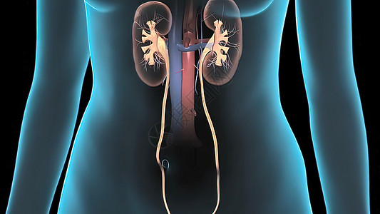 人类腹部面积 皮肤透明 显示肺部 胃部 直肠保健教育尿液状况肾脏身体单位疾病模拟输尿管图片