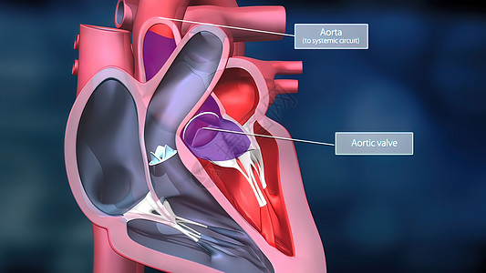 心脏工作系统 通过人体血液抽血心绞痛设计生物学信息动脉粥样硬化身体生理主动脉图表心脏病背景图片