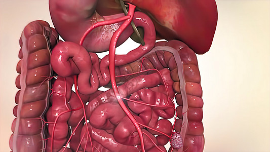 3d 医疗治疗肿瘤组织技术医生解剖学疾病微生物药品癌瘤癌症图片