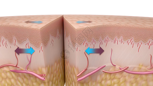 3D 皮肤伤口愈合时间的医疗说明科学图表康复润肤动脉真皮皮肤科改造插图血管图片