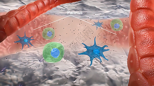 T细胞大型巨形相互作用和血管炎中形成颗粒瘤抗原感染结构抗体免疫药品癌症生物细胞因子显微镜图片