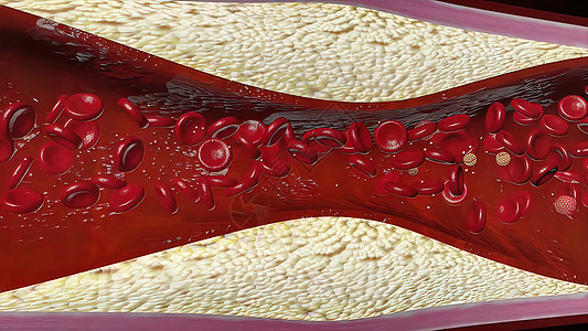 高密度脂蛋白HDL胆固醇甾醇药品生物学作品化学品化合物心血管脂肪血清纽带图片