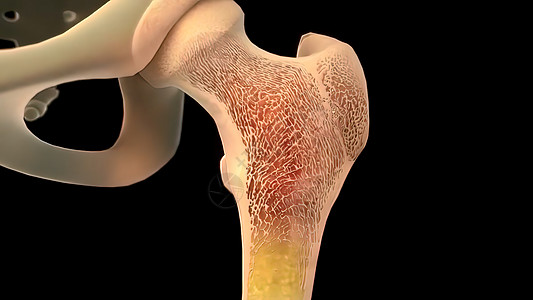 骨骨内部结构3D医疗图片