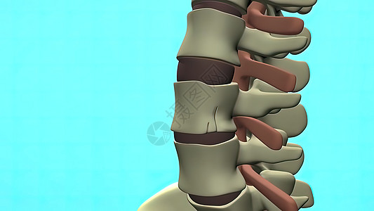 3D型医疗盘片创伤医院身体光盘科学压缩医生外科脊柱放射科图片
