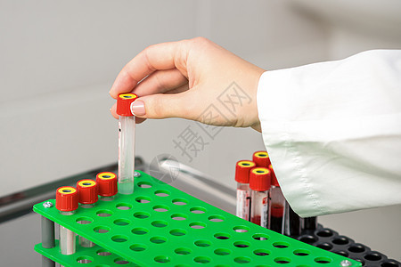 护士抽空验血管样本教育药品技术疾病诊所疫苗生物学女性实验图片