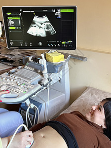 孕妇在腹部超声波上怀孕 产科推子钮扣图片