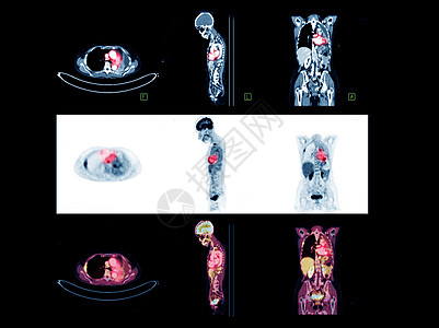 PET 整个身体扫描图像比较轴心 科罗纳尔和人造平面f图片