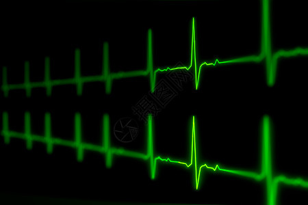 ECG或EKG脉动心跳 生命标志绿线3D插图背景图片