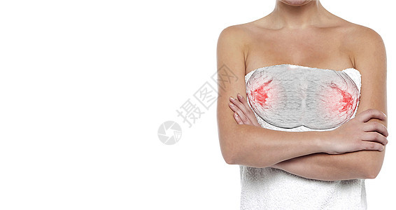 身上有浴巾的女人 排骨道照片x线放射科医院癌症诊断预防幸存者检测专家图片