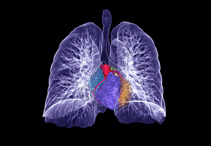 CT 肺3d 肝脏成象电脑结节屏幕心血管电影隔膜插图肋骨心脏病学医生图片