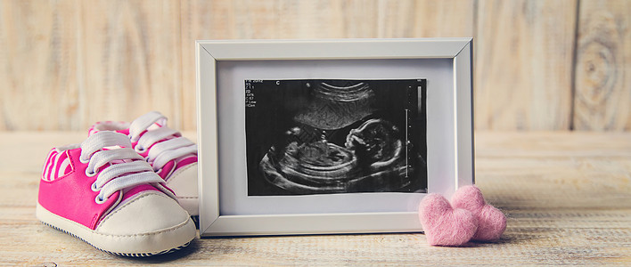 婴儿的照片和配件的超音速照片 有选择的聚焦点生活扫描胎儿技术母亲横幅超声波腹部药品检查图片