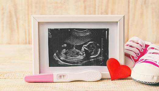 婴儿的照片和配件的超音速照片 有选择的聚焦点新生怀孕技术男生女士子宫扫描超声胎儿声呐图片