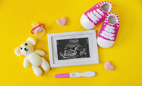 婴儿的照片和配件的超音速照片 有选择的聚焦点孩子新生超声波父母技术男生检查怀孕生活子宫图片