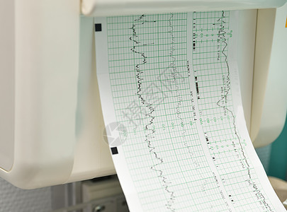用于测量收缩 孕妇心跳的监视器;图片