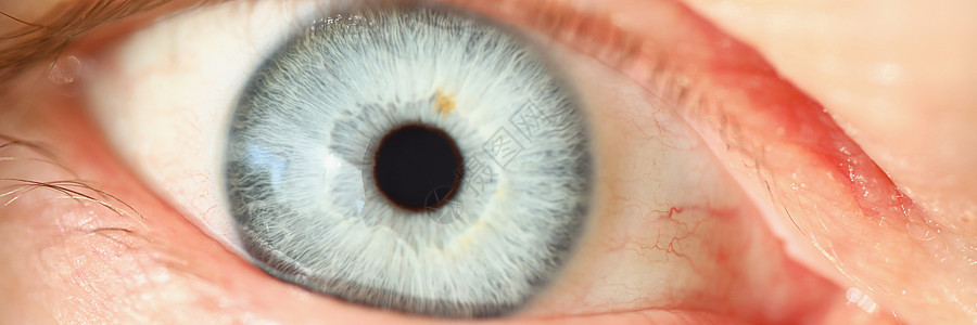 浅蓝人眼色 人类视觉的极端宏观光谱阴影器官配镜师眼科眼球医生生物学雀斑鸢尾花药品图片