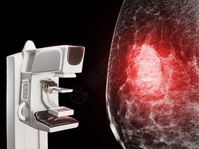 X射线数字乳房X光照相机和乳房X光照相机 用于隔离在黑人背景下的妇女的宫颈癌诊断图片