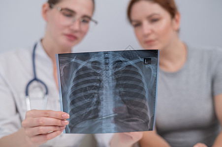 医生咨询一名天主教妇女 并对肺部X光片进行评论外科癌症病人卫生检查肺炎胸部保险诊断医院图片