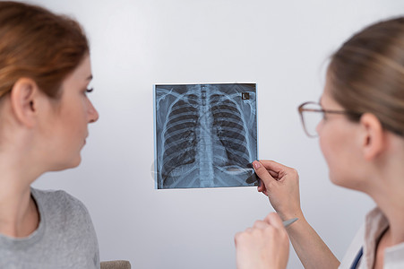 医生咨询一名天主教妇女 并对肺部X光片进行评论疾病检查电影胸部外套放射科女士肺炎病人诊所图片
