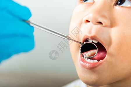 医生检查幼儿口腔孔口腔 用嘴镜检查牙齿洞口女孩镜子女士医院童年牙科女性保健工具牙医图片