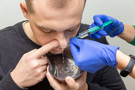 护士把病人的鼻腔洗干净治疗注射器技术症状鼻子过敏感染药品疾病小路图片