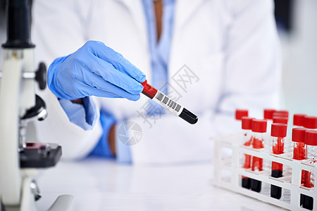 一名科学家在实验室里用血液样本做实验 他的工作很出色图片
