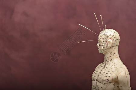 头部有针头的针刺模型刺激学习身体中医医疗管理疗法能量中药免疫系统图片
