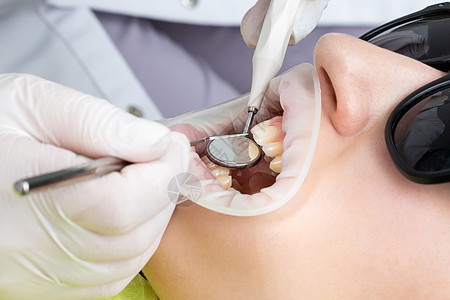 诊所内有牙科镜的病人嘴腔和牙科镜医生临床卫生药品镜子乐器反射工具牙齿成人图片